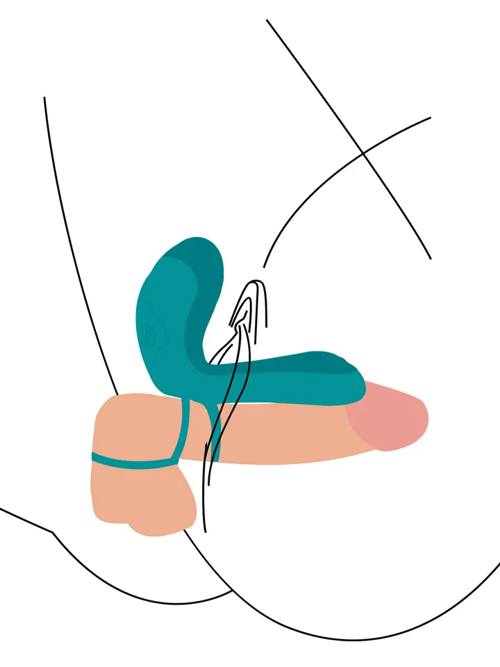 Couples Vibrator Ring - Vibrējošs gaiļa gredzens 2